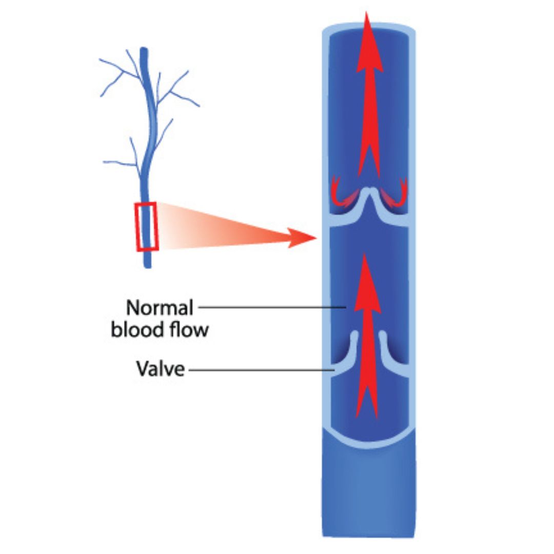Izboljšan naravni pretok