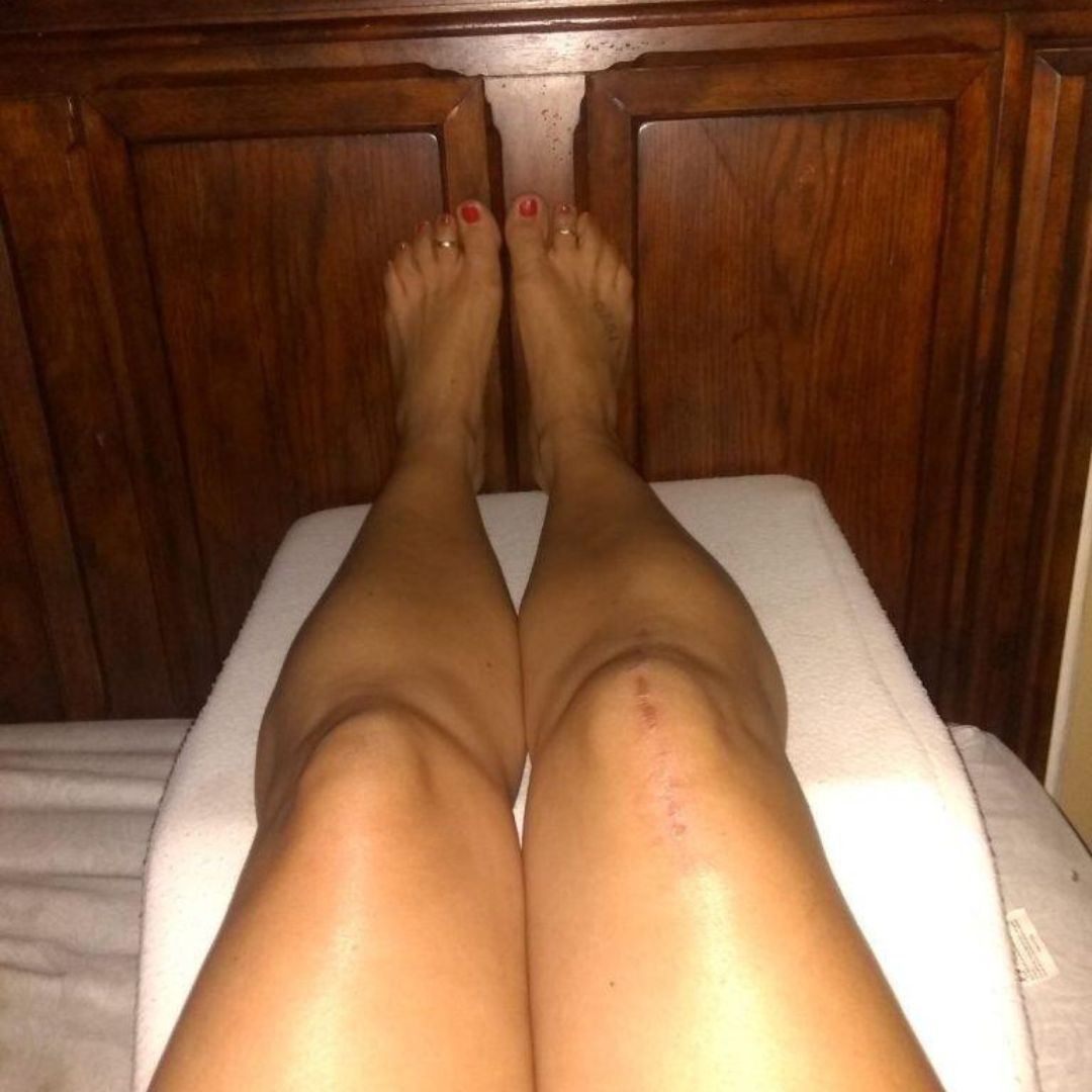 Uporabnica Tina z blazino Medical