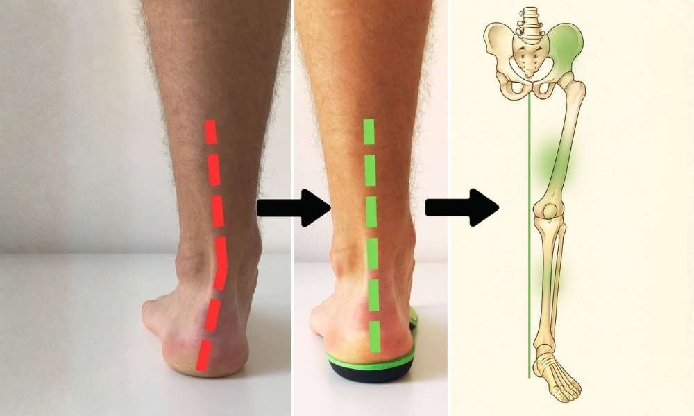 Orthexa Vzdržljivost