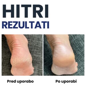 Vlažilne nogavice za razpokane pete - Heel - Image 2