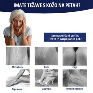 4-delni pripomoček za nego stopal - SoftFeet - Image 3