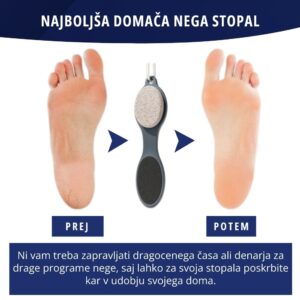 4-delni pripomoček za nego stopal - SoftFeet - Image 4