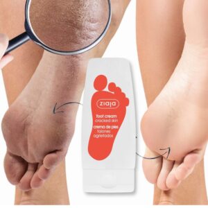 ZIAJA Krema za razpokano kožo stopal 60 ml - Image 4