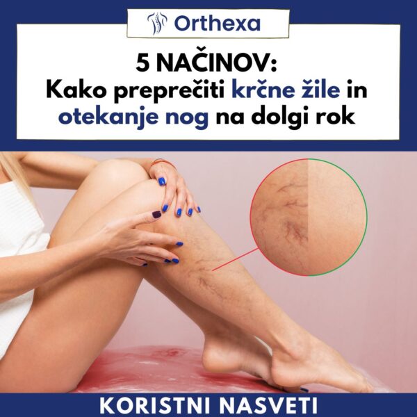 5 NAČINOV Kako preprečiti krčne žile product (1)